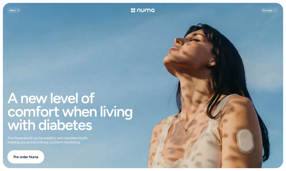 Numa